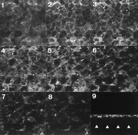 Confocal Laser Scanning Electron Microscopy Analysis Of CD55