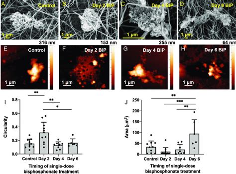 BiP treatment altered microcalcification morphology in a time-dependent... | Download Scientific ...