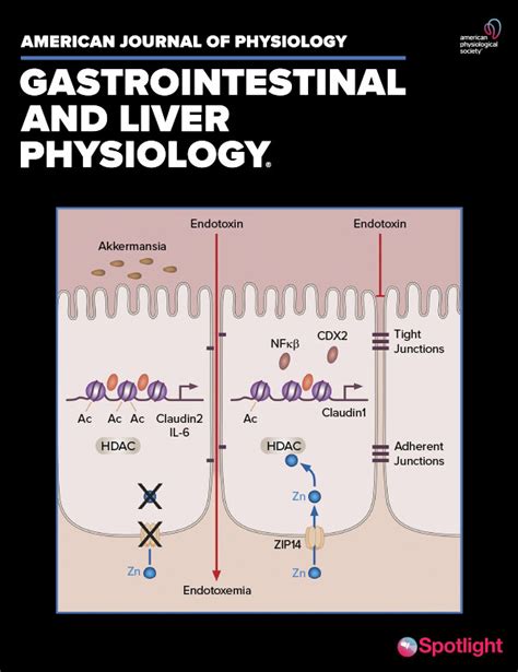 Enterocyte Specific Deletion Of Metal Transporter Zip14 Slc39a14