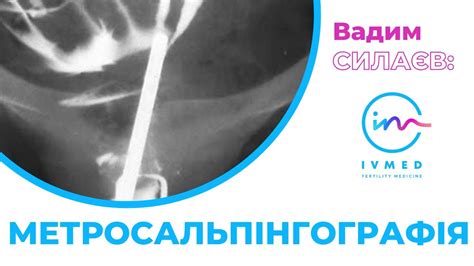 МЕТОДИ ДОСЛІДЖЕННЯ ПРОХІДНОСТІ МАТКОВИХ ТРУБ: МЕТРОСАЛЬПІНГОГРАФІЯ ...