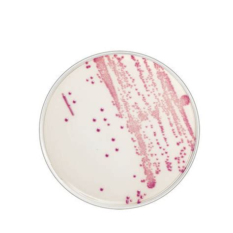 Agar Gel Reagent Flexicult Id Ssi Diagnostica Pathology