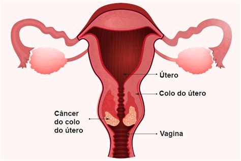 Notícias Campanha Março Lilás Conscientiza E Orienta Sobre Prevenção