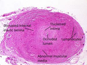 Neuron Histology Labeled