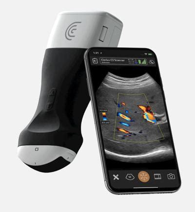 Clarius Ultrasound Scanner For Iphone Android Uds