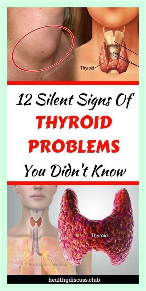 10 Signs Your Feet Are Warning You About A Thyroid Problem Artofit