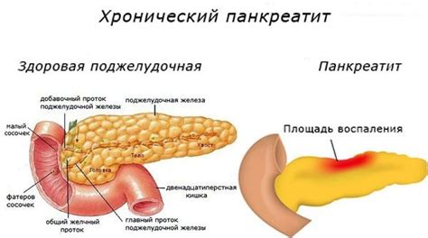 Альфа амилаза повышена в крови - причины, норма и лечение у взрослых