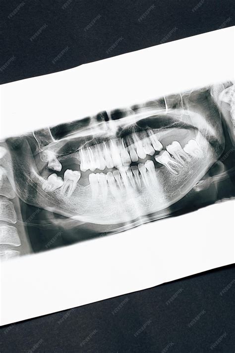 premium photo panoramic picture   jaw  black background