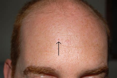 pore - définition - What is