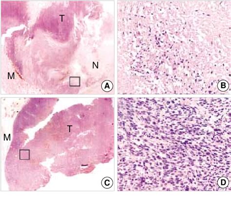 Figure 2 From Intratumoral Injection Of 188Re Labeled Cationic