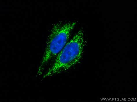 Lonp1 Antibody Cl488 15440 Proteintech