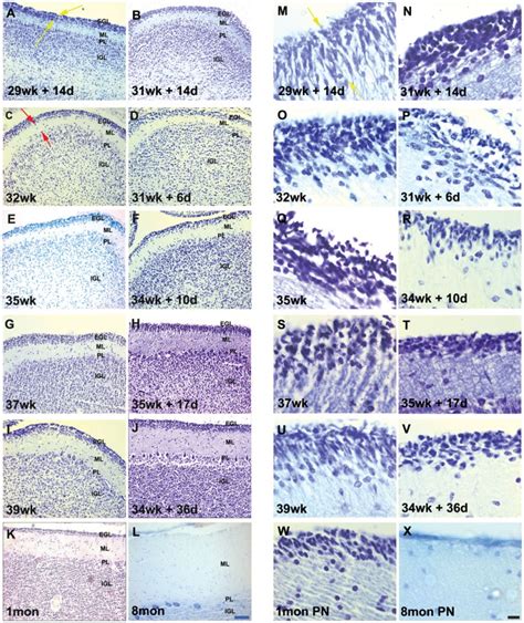 Neural - Cerebellum Development - Embryology