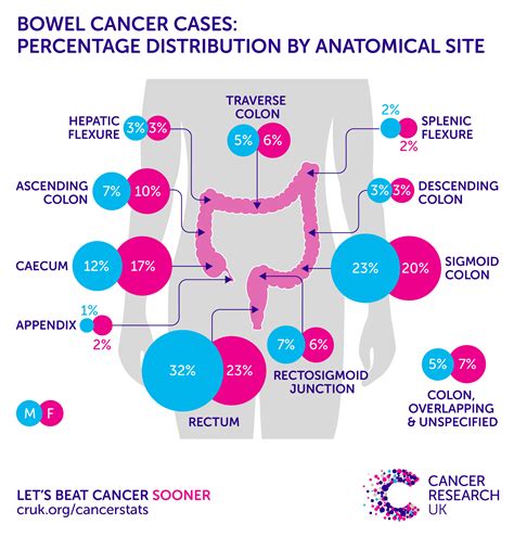 Bowel cancer incidence statistics | Cancer Research UK