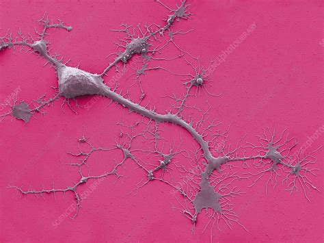 Stem Cell Derived Neuron Sem Stock Image C Science Photo