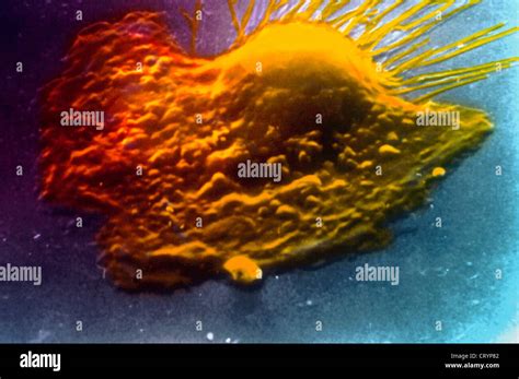 Tissue Macrophage Hi Res Stock Photography And Images Alamy