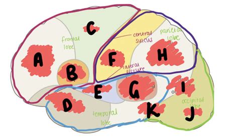 Neuroanatomy 2 Flashcards Quizlet