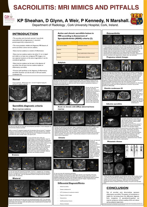 (PDF) SACROILIITIS: MRI MIMICS AND PITFALLS