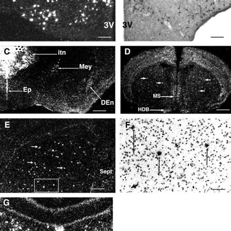 Maoa And Maob Mrna Expression In The Telencephalon Maoa A B And Maob