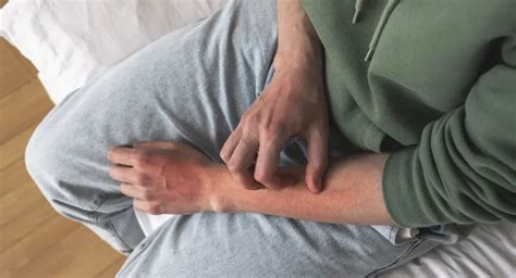 Excoriation Disorder Symptoms Causes And Therapy Options