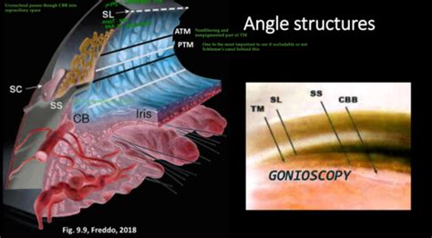 Glaucoma Gonio Flashcards Quizlet