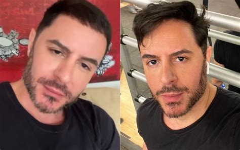 Ricardo Tozzi Nega Harmoniza O Facial Mudou Foi O Cabelo Que Eu