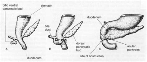 Annular Pancreas Embryology