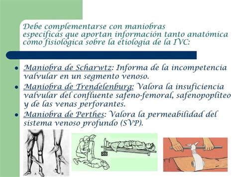 Insuficiencia Venosa Cr Nica Ppt