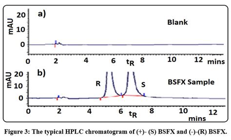 Chiral Ionic Liquid Based Vortex Assisted Enantio Separation Of S