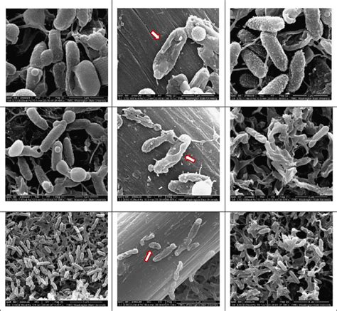 Scanning Electron Microscopy Sem Images Showing Untreated E Scaffold Download Scientific