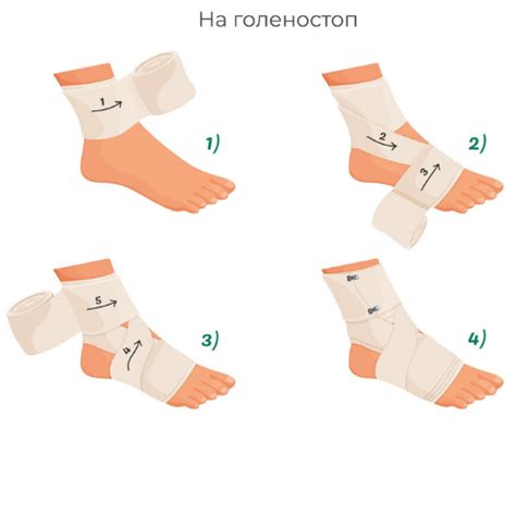 Для чего нужен эластичный бинт? | Med-magazin.ua - cеть магазинов ...