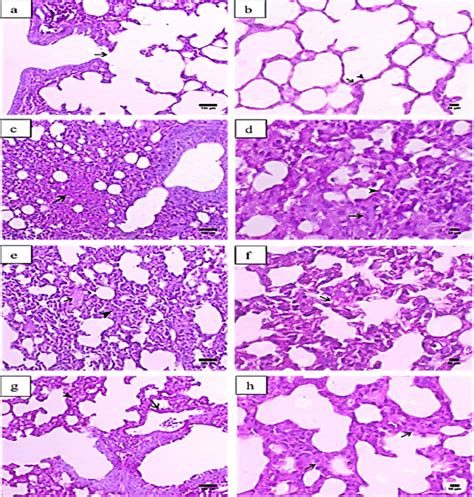 Histopathological Graphs Of Lung Sections From All Groups The Lung