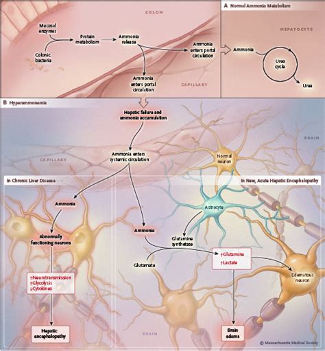 Putative Mechanisms Underlying Hepatic Encephalopathy And Brain Edema