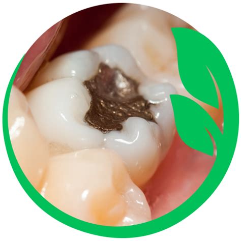 Safe Mercury Amalgam Removal Integrative Dental Care