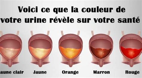 V Rifiez La Couleur De Votre Urine Cela Peut Sav Rer Utile