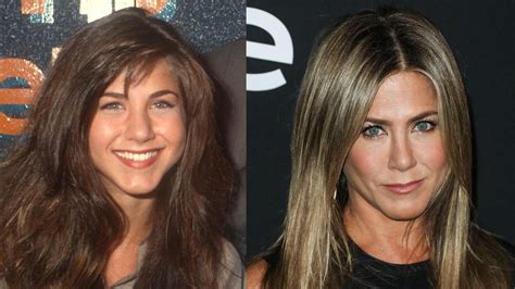 Before And After Pics Celebrities Who Had Rhinoplasty