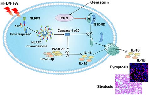 Estrogen Receptor α Regulates Metabolic Associated Fatty Liver Disease