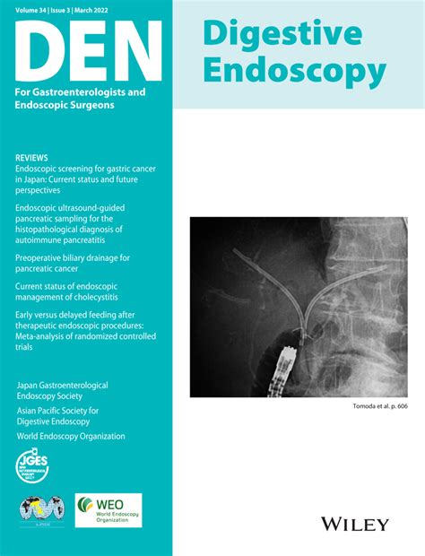 Endoscopic Approach In The Diagnosis Of High‐grade Pancreatic Intraepithelial Neoplasia Hanada