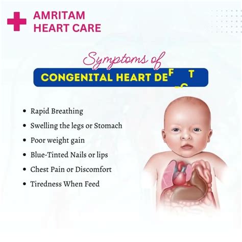 Know About Congenital Heart Defects Chd Symptoms And Causes Of Chd