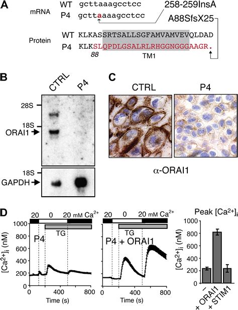 ORAI1 Deficiency And Lack Of Store Operated Ca2 Entry Cause