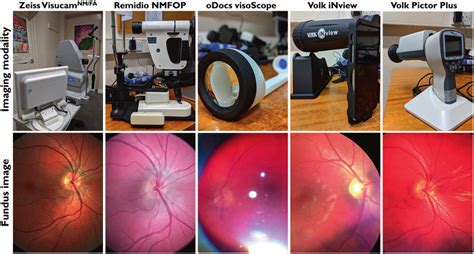 Overview Of Table Mounted And Handheld Fundus Cameras And Fundus