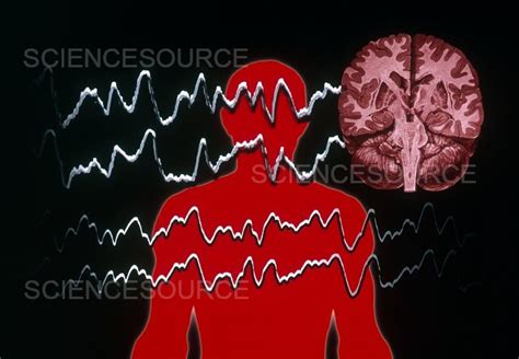 EEG of Tonic-clonic Seizure | Stock Image - Science Source Images