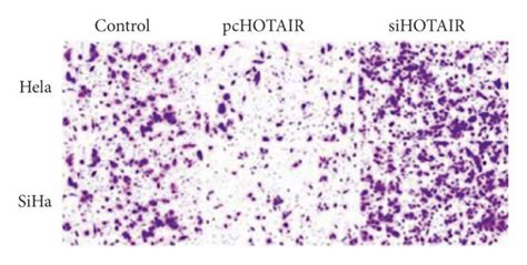 Hotair Promoted Migration And Invasion Of Cervical Cancer Cells In Download Scientific Diagram