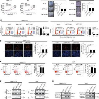 Mtp Knockdown Suppresses Hcc Cell Growth By Inhibiting G S Cell