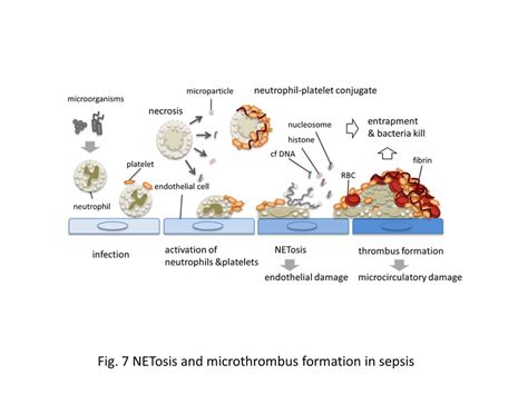 Netosis And Microthrombus Formation In Sepsis Microbes Activate The