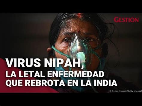 Virus Nipah Qu Es La Mortal Enfermedad Que Rebrota En La India Y C Mo