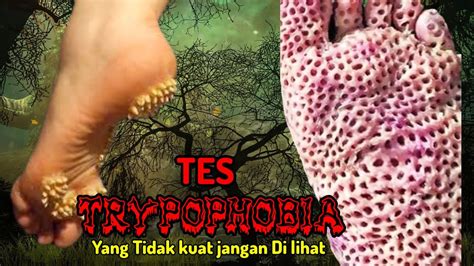 Trypophobia Kaki Bolong Bolong Dan Muka Bolong Bolong Youtube