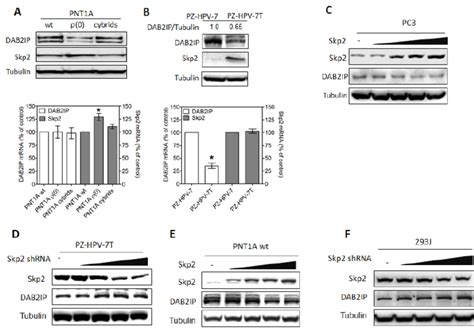 Inverse Correlation Between Dab2ip And Skp2 Expression In Prostatic