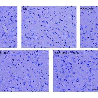 representative images  nissl staining  analysis  intact cells
