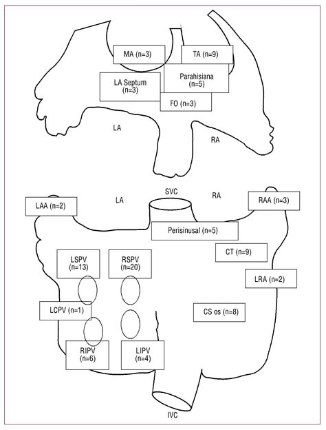 Atrial Tachycardia Originating From The Pulmonary Vein Clinical