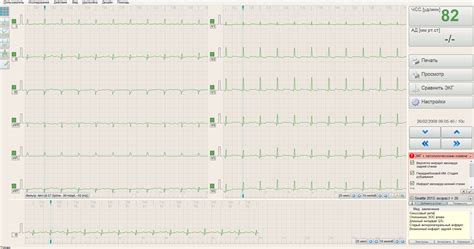 BTL CardioPoint EKG C600 BTL zdravotnická technika a s