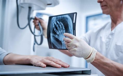 Mature Female Patient And Medical Technician During Hand Xray